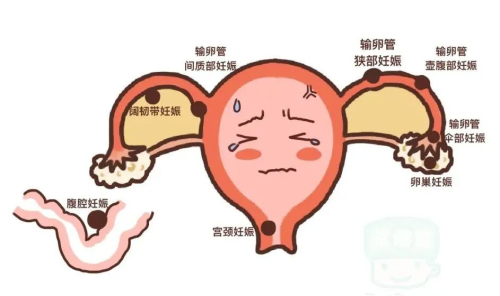 mеķ
